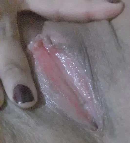 Upitissss
