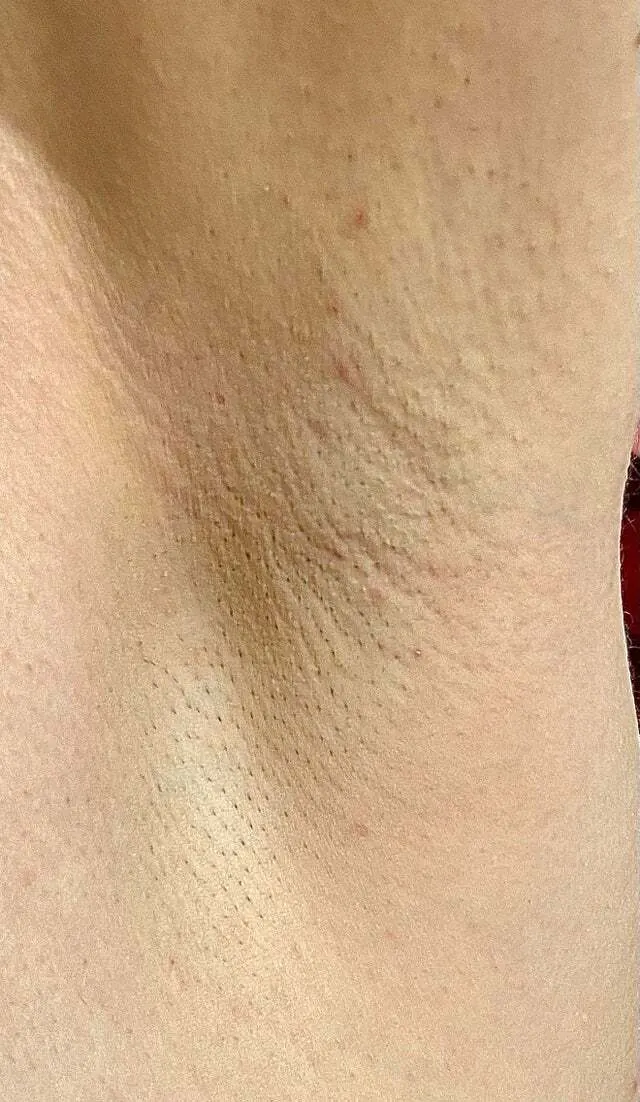 Axilas Femeninas 🔥 6 (armpits fetish)