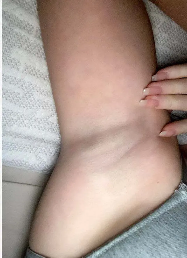 Axilas Femeninas 🔥 6 (armpits fetish)