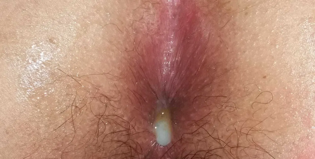 Mi cola