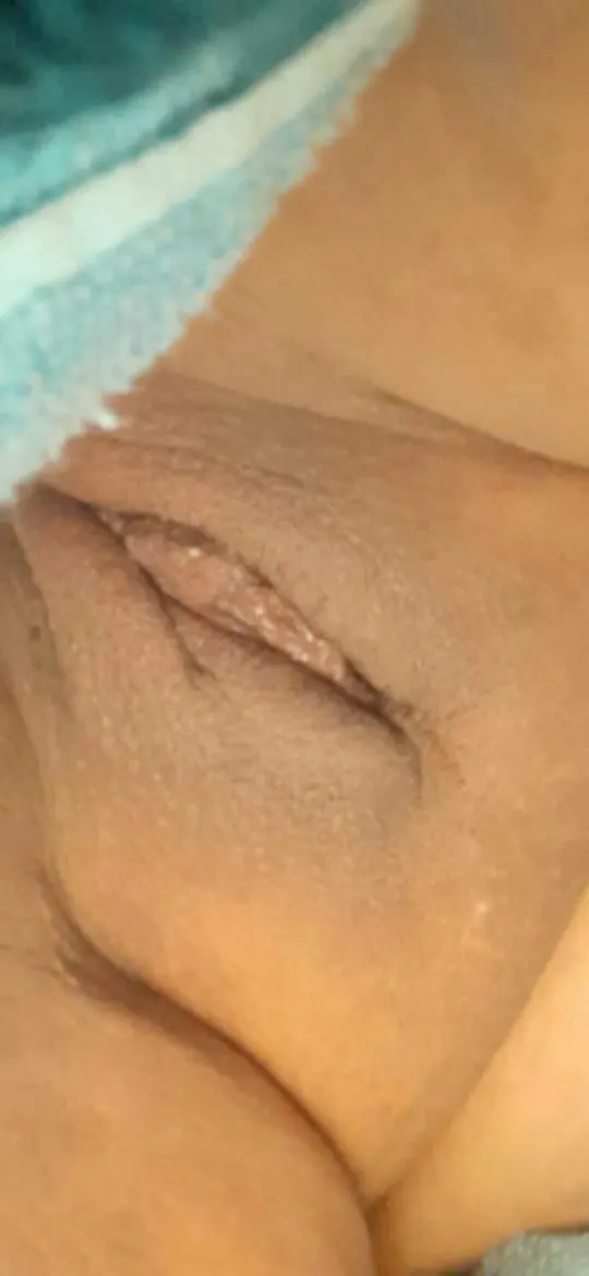 Imágenes amateur.