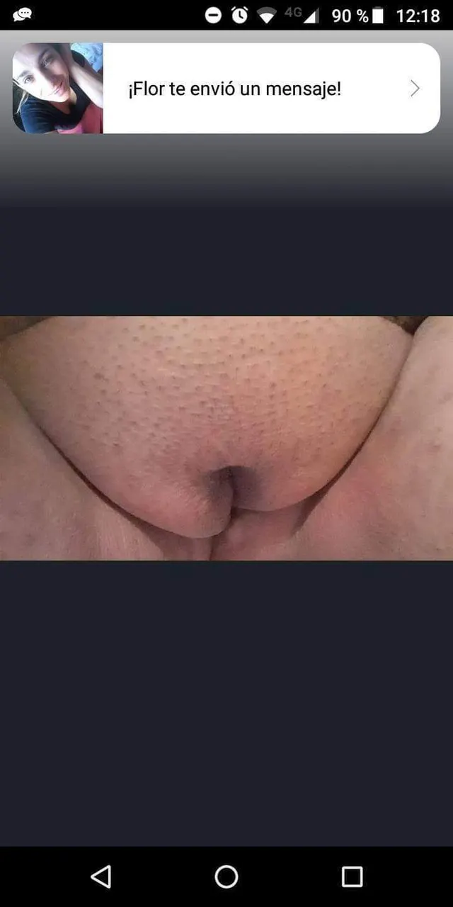 Ig amatute