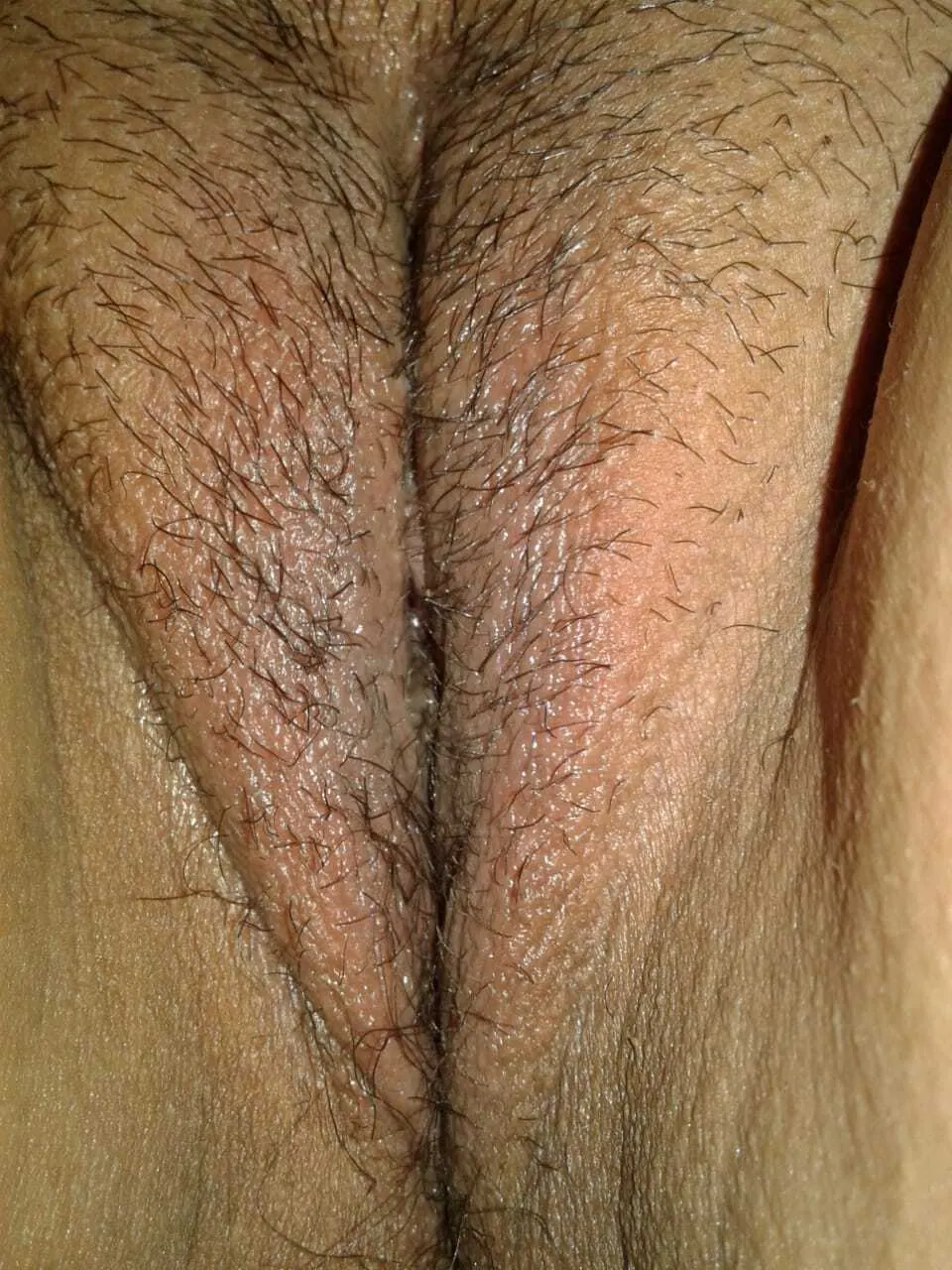 Peludita y peladita