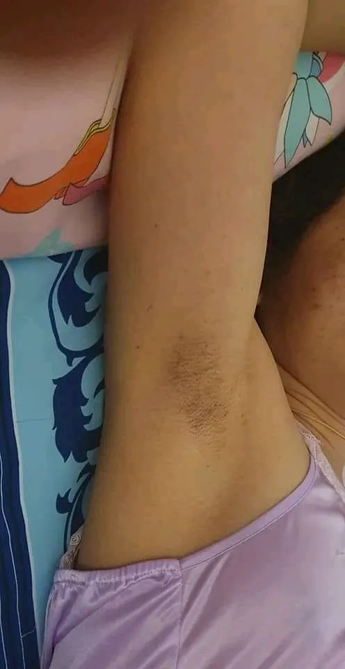 Axilas Femeninas 8 (fotos amateur)