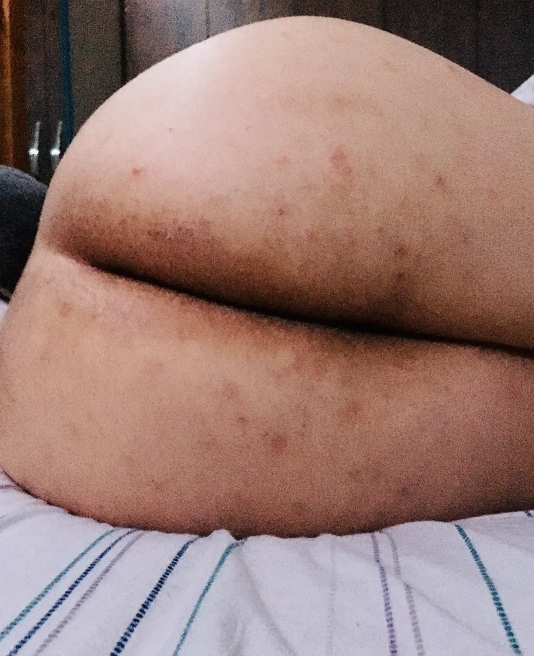 Previas al anal!