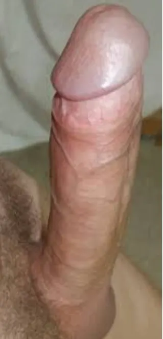 Aburridito en la plata