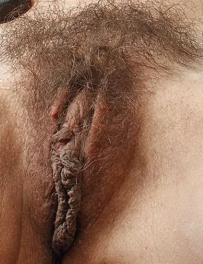 Conchas upitis y ortos