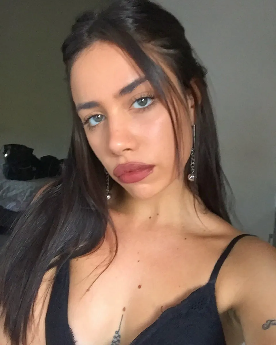 Mica, con labios de tiragoma mal