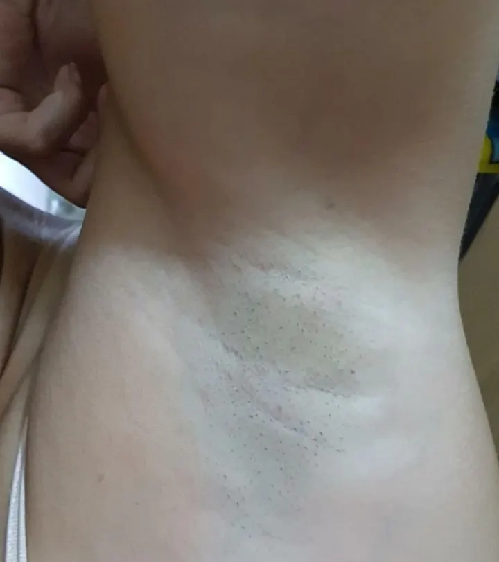 Axilas Femeninas 6 (fotos amateur)