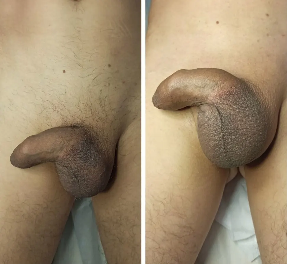 La Doctora Peronista Y Su Método De Crecimiento Del Pene