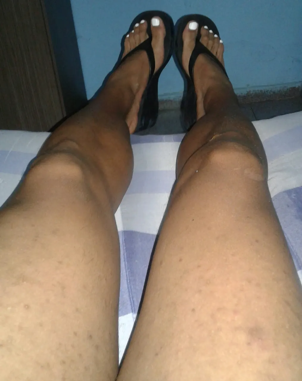 Feet and legs