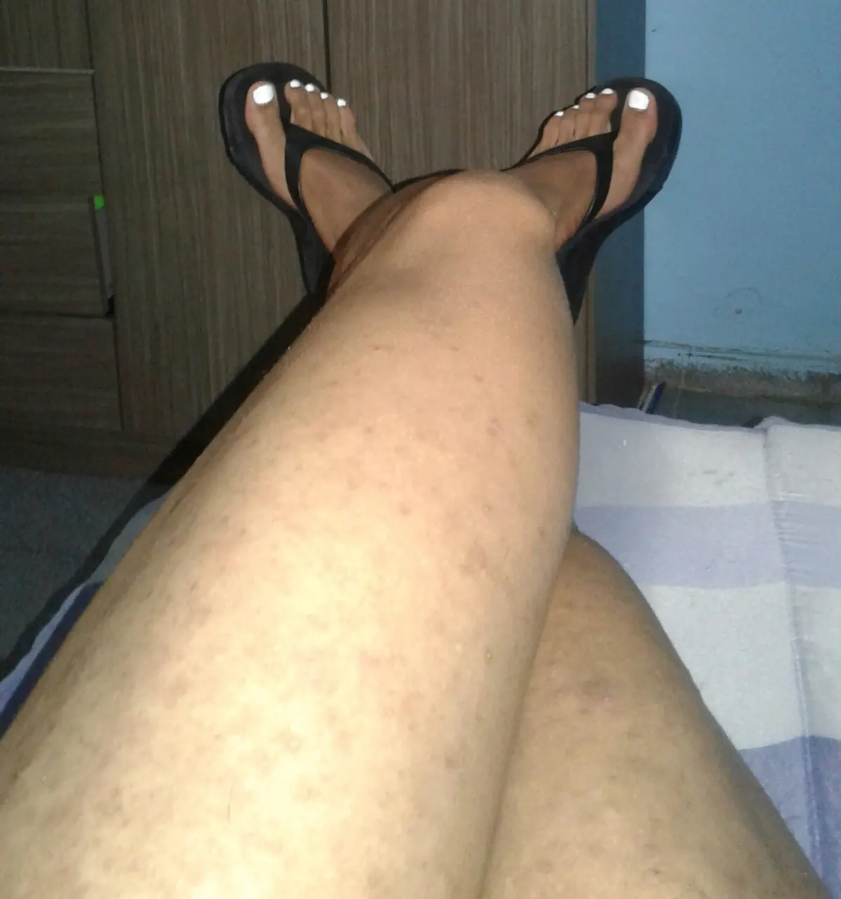 Feet and legs