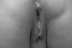 White Drops